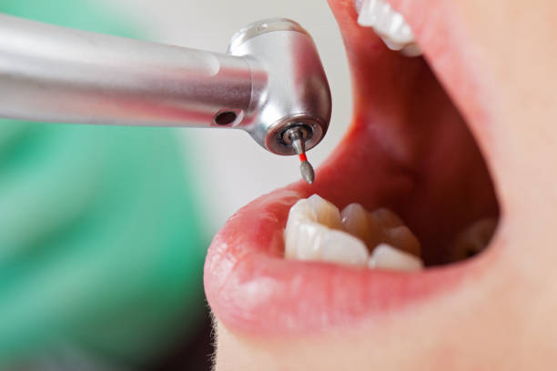 Best Weekend Emergency Dentist in Fredonia, KS